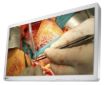 Billede af EIZO 32'' CuratOR 4K 12G UHD surgical monitor