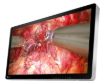 Billede af EIZO 32'' CuratOR 3D 4K 12G UHD surgical monitor