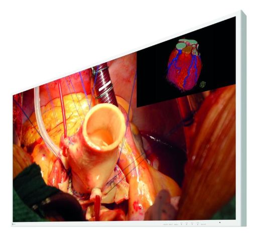 Billede af EIZO 43'' CuratOr 4K monitor