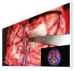 Billede af EIZO 55'' CuratOR 4K UHD surgical monitor