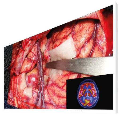 Billede af EIZO 55'' CuratOR 4K UHD surgical monitor