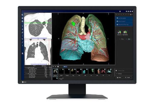 Billede af EIZO 24'' RadiForce Color 2.3MP
