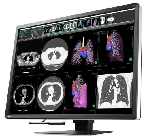Billede af EIZO 12MP 30,9'' Radiforce diagnostisk monitor