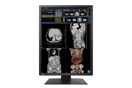 Billede af EIZO 2MP 21,3'' RadiForce Color HightBrightness LED