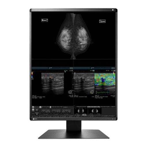 Billede af EIZO 21,3'' Mammo Color monitor