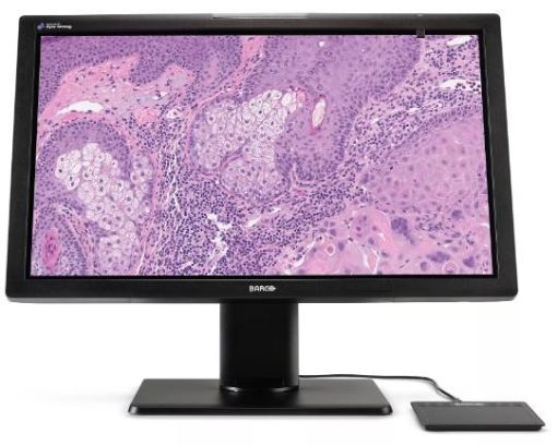 Billede af BARCO MDPC-8127 Color Digital Pathology Display